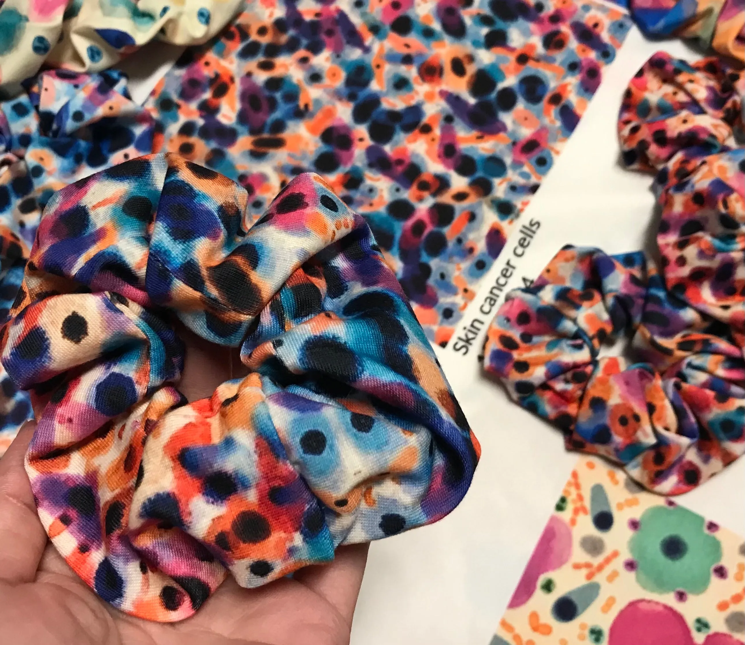 Skin cancer hair scrunchies - squamous cell carcinoma